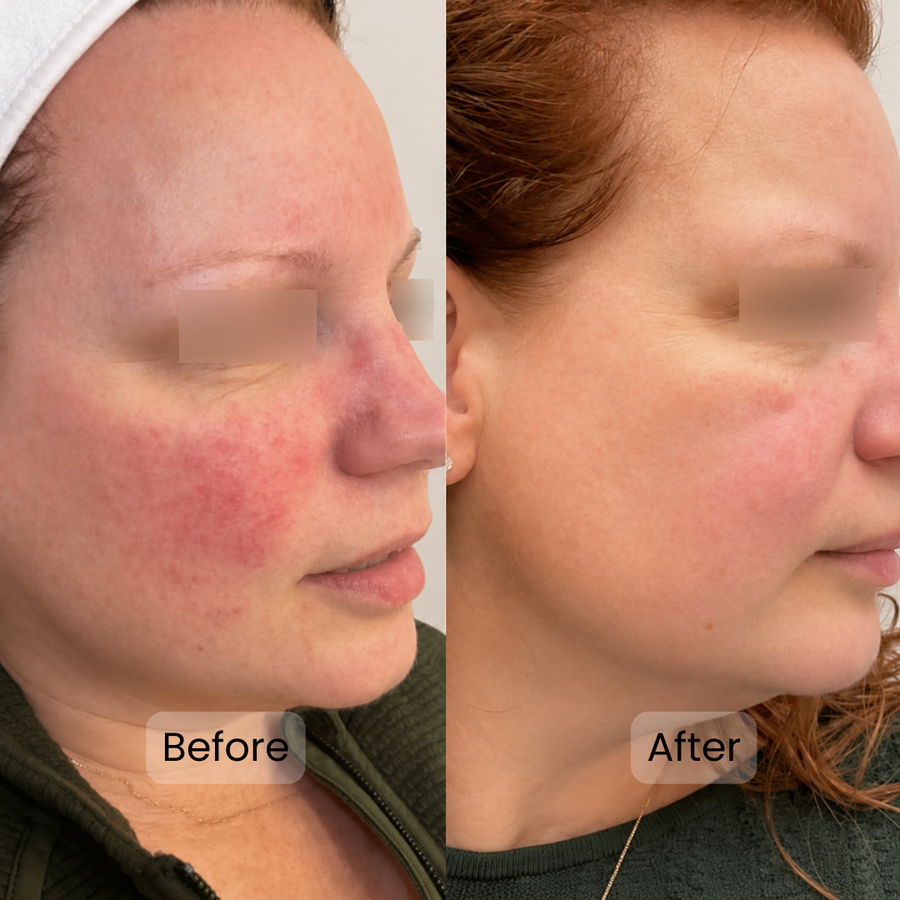 Less random flares and healthy skin